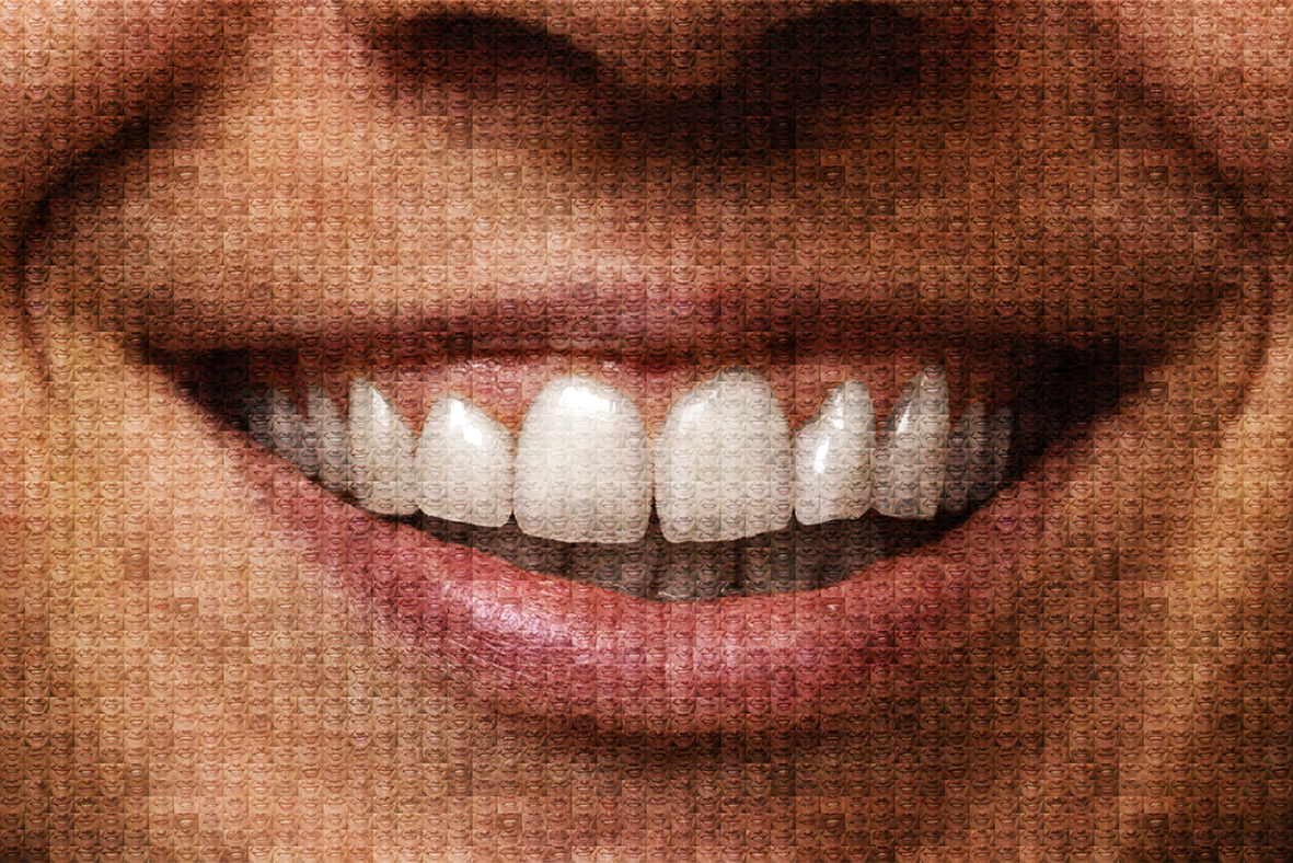 Bild eines Lächelns, welches aus vielen kleinen Bildern eines Lächelns zusammengesetzt ist. 