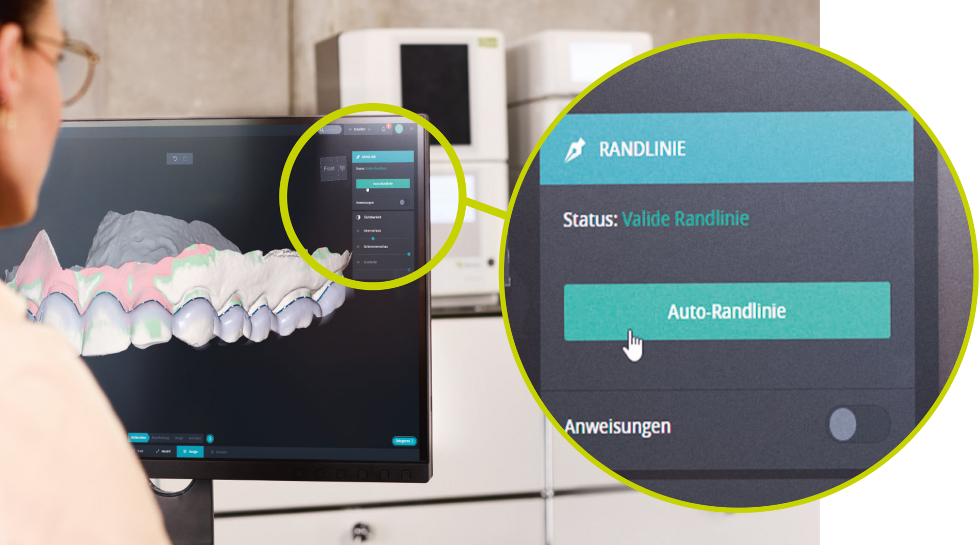 DentaMile Aufbissschienen Workflow Auto Randlinie