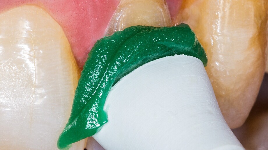 Flairesse Paste | Prophylaxepaste | kein Spritzen Paste auf Polierkelch