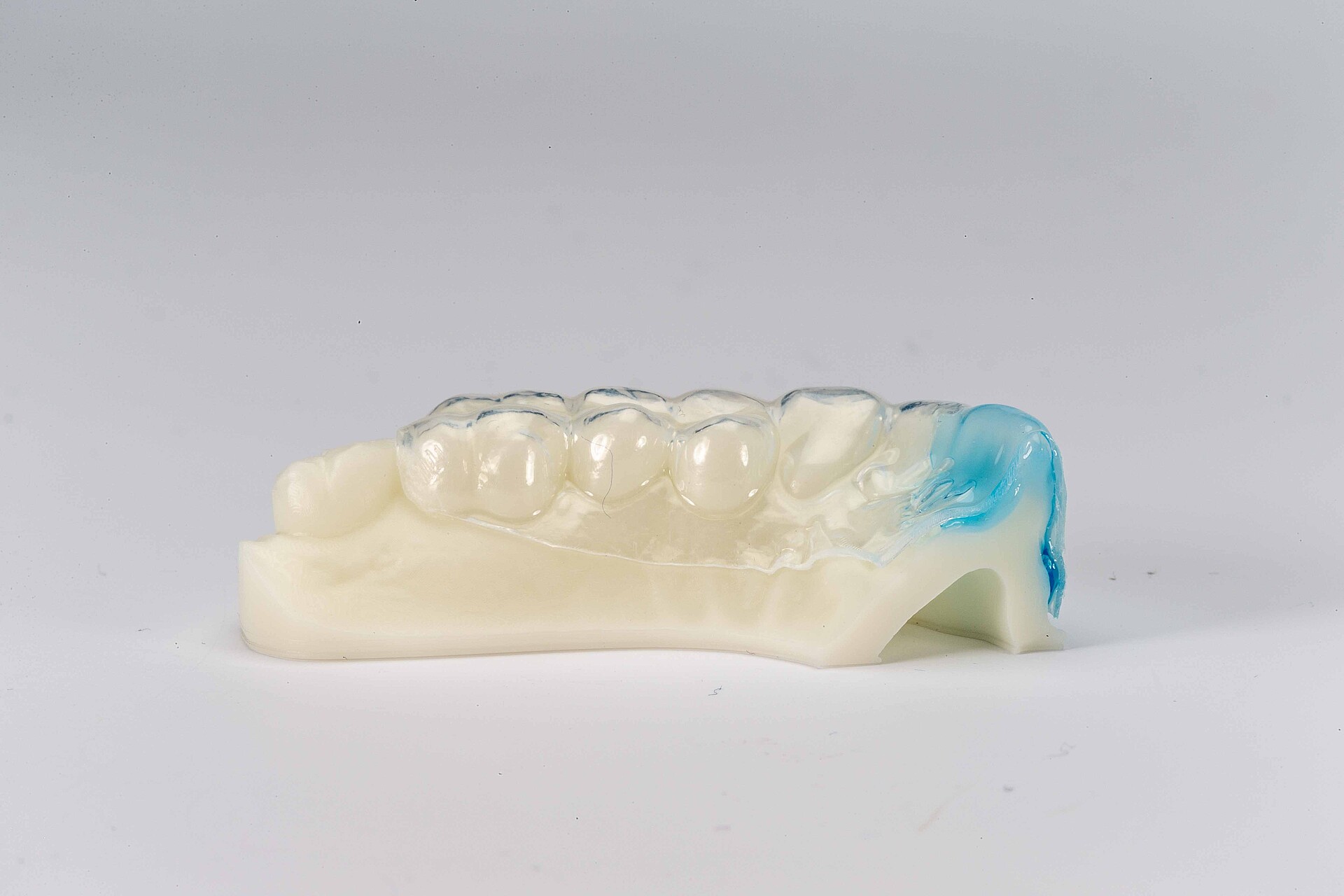Thermoplast-Bleaching-Schiene