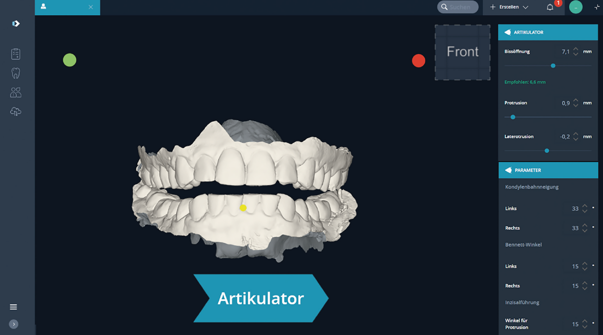 DentaMile Aufbissschienen Workflow Artikulator