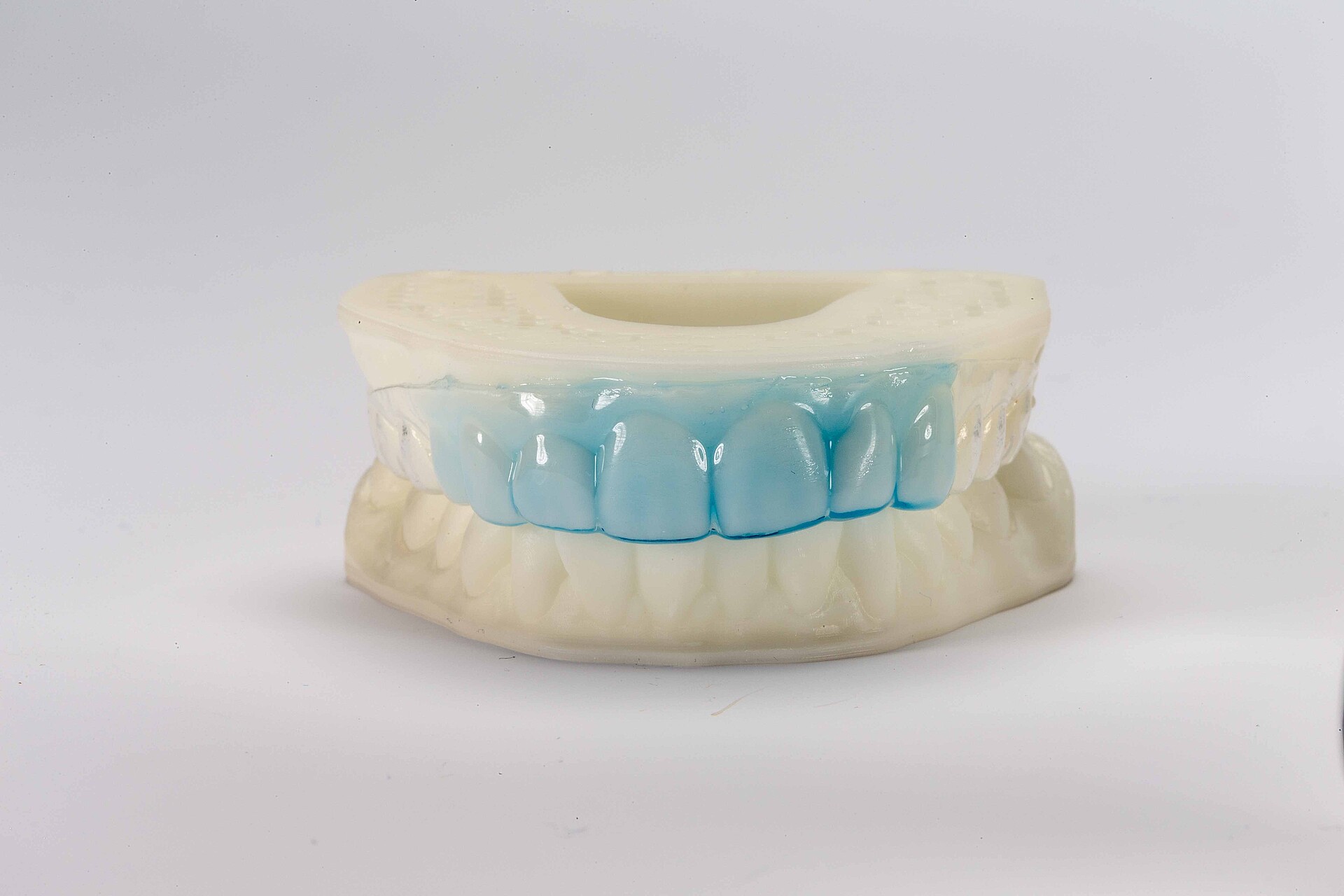 Thermoplast-Bleaching-Schiene