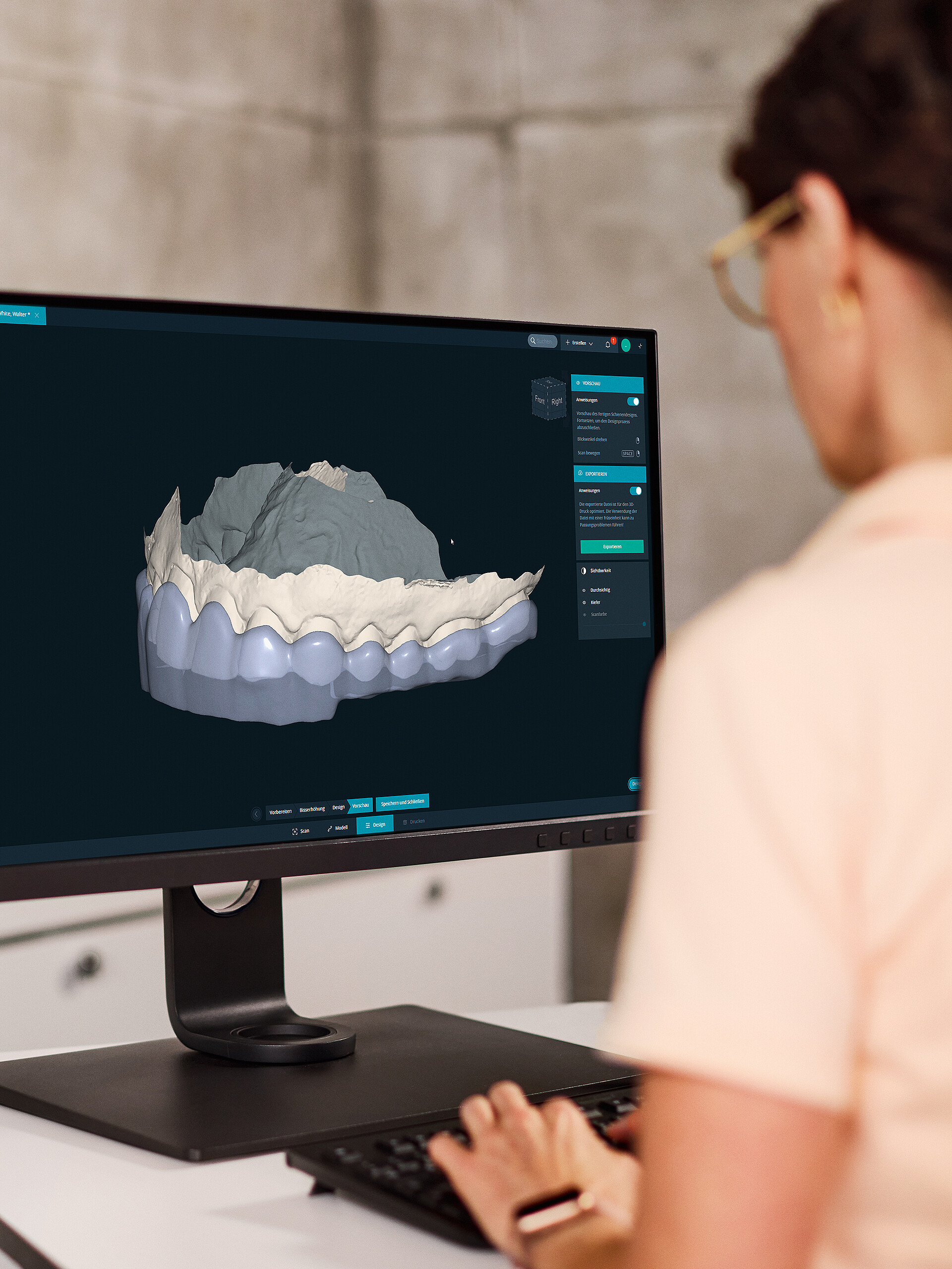 DentaMile Aufbissschienen Workflow WIN