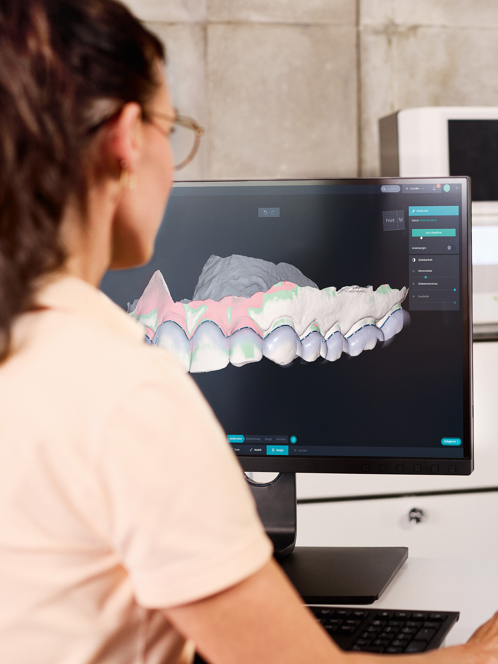 DentaMile Aufbissschienen Workflow Prozess Kachel