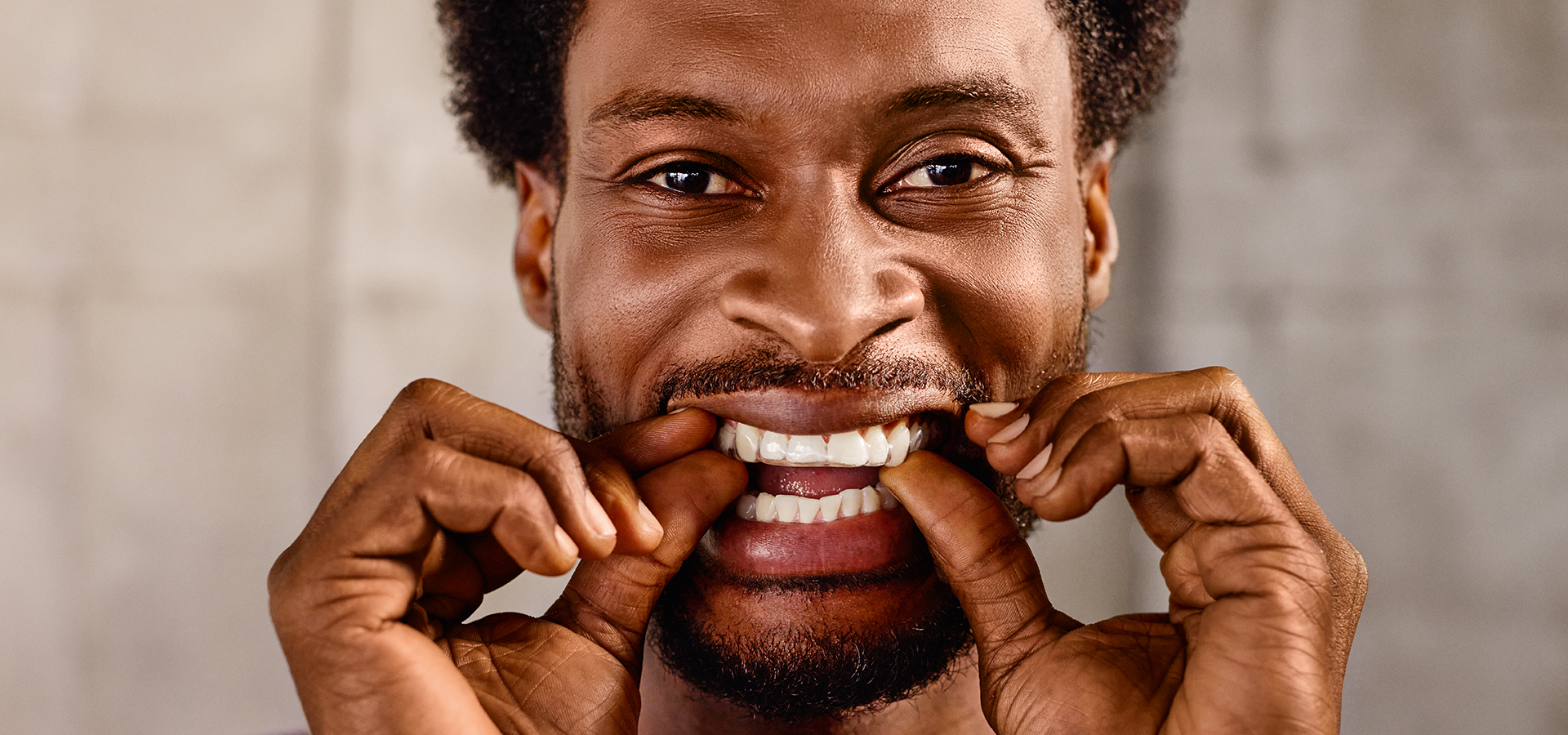 DentaMile Aufbissschienen Workflow Ergebnis Patient
