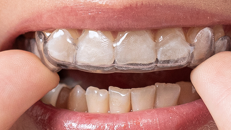 LuxaPrint Ortho Plus