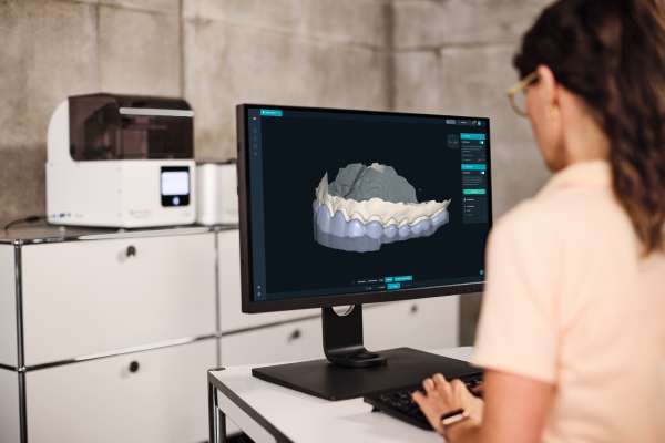 Eine Frau vor einem Bildschirm bei der digitalen Erstellung einer Aufbissschiene